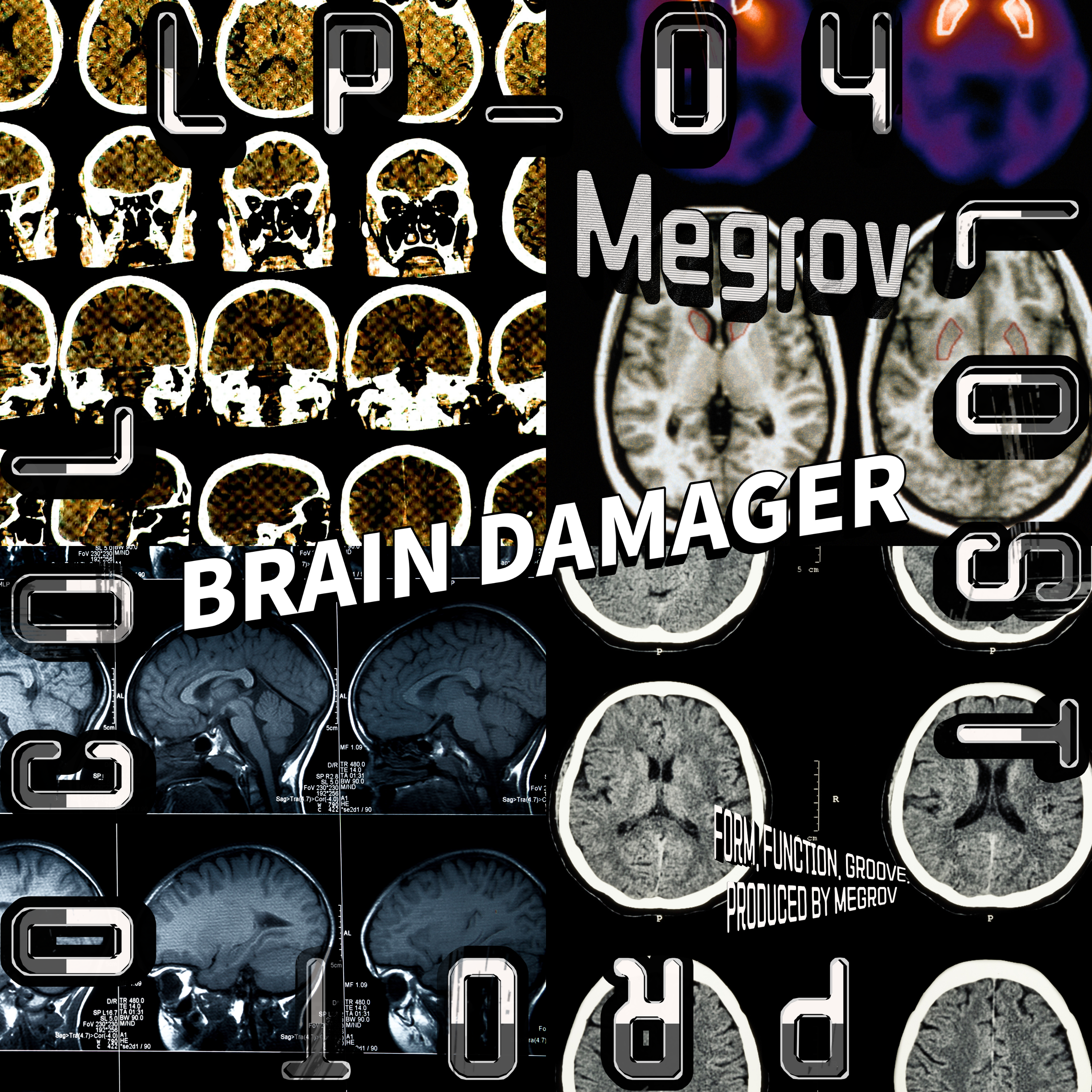 Brain Damager Cover - Megrov